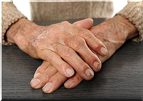 relieve arthritis