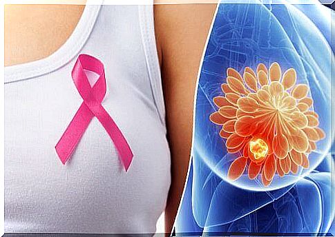 10 signs of breast cancer