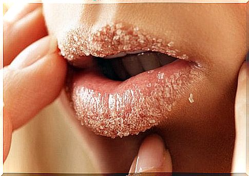 2-dry lips