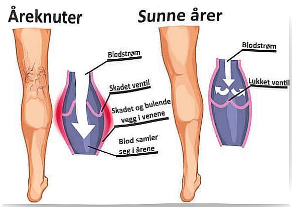 3-areknuter-healthy-arer