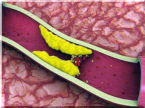 8 teas to lower cholesterol naturally