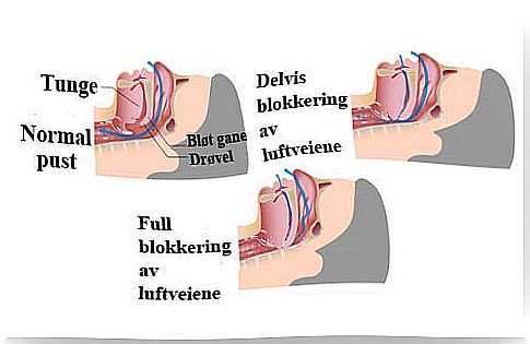 Aids against snoring