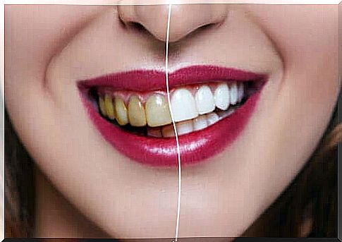 The causes of discolored teeth