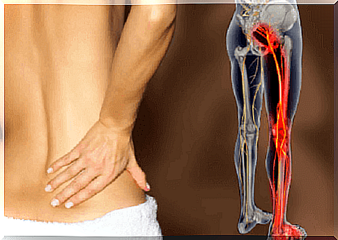 Extracts and advice on treating sciatica