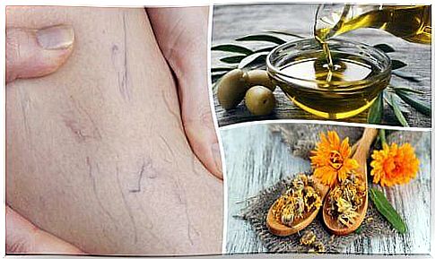 Get rid of varicose veins with olive oil and marigolds