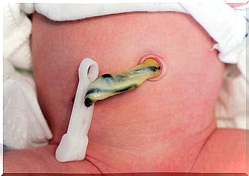 The navel of a newborn baby.