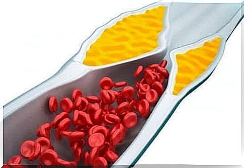 Cholesterol in the blood.