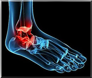 Osteoarthritis of the ankles