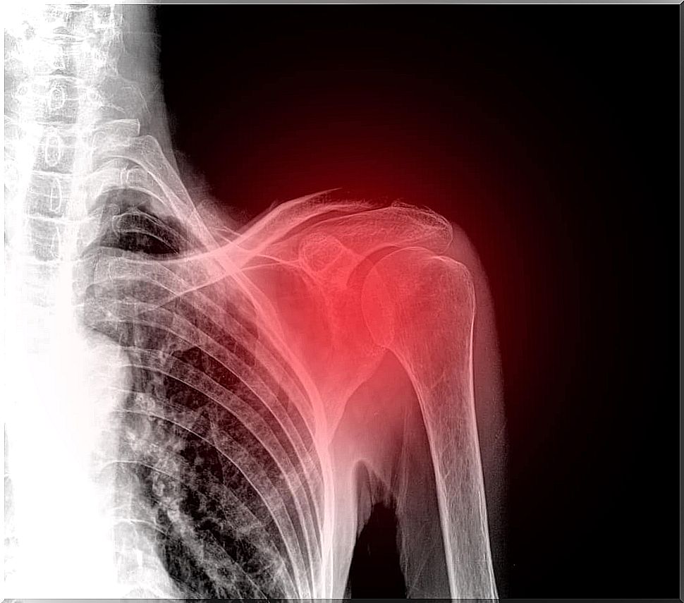 Reduce shoulder pain with these homemade remedies