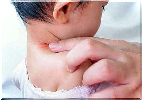 Torticollis: Symptoms and treatment